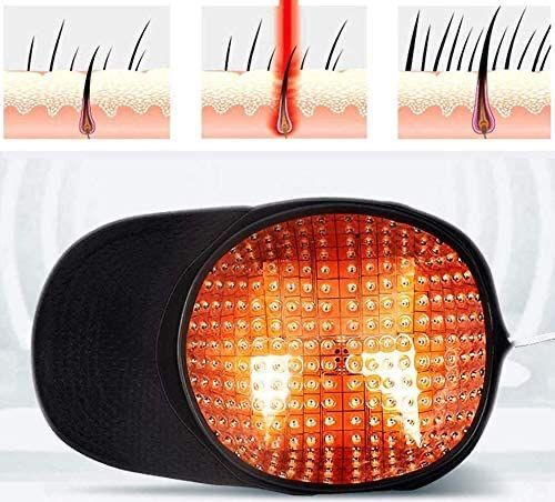 Лазерный шлем для лечения выпадения волос
